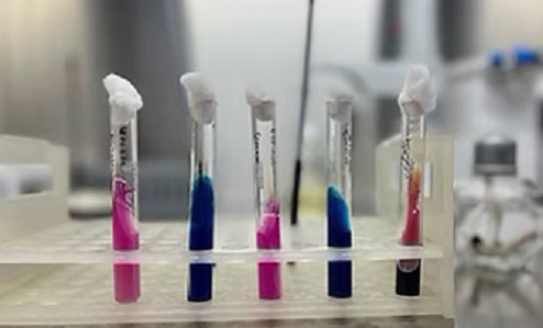Serology Department