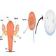 Pap Smear